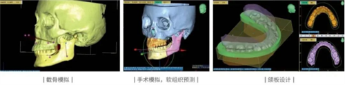 助力数字化口腔颌面正畸修复，领智三维参加2023华南国际口腔展1380.png