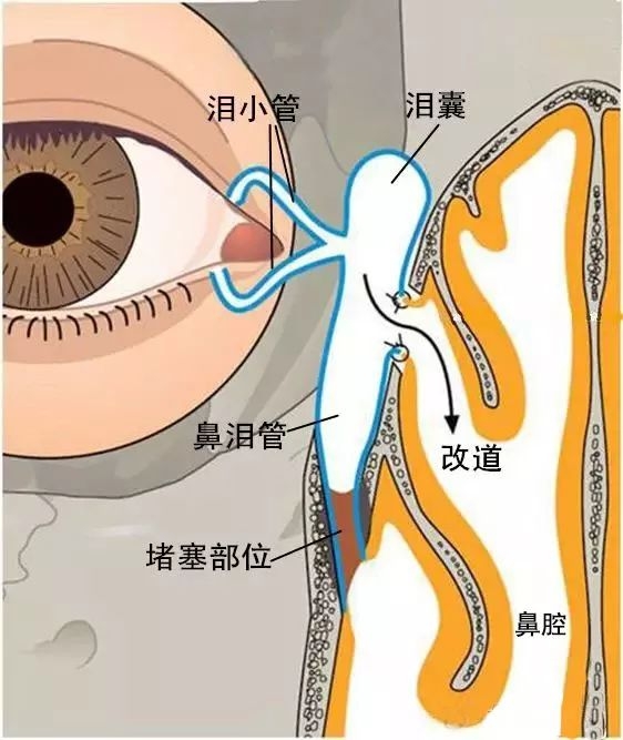 长沙市爱尔眼科成功实施鼻内镜手术 医院眼眶病诊治技术迈上新台阶