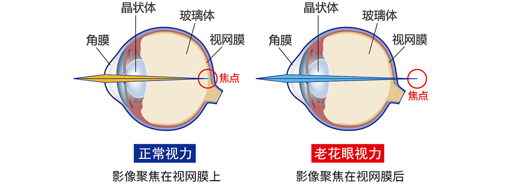 揭秘早老花：蔡司智锐渐进镜片如何助力职场人应对视力挑战